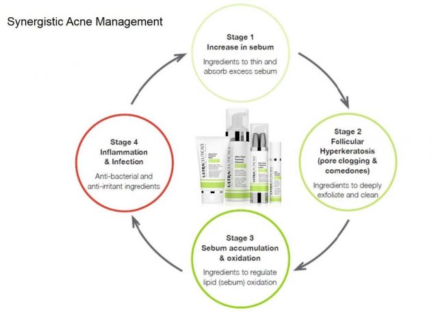 Synergistic Acne Management