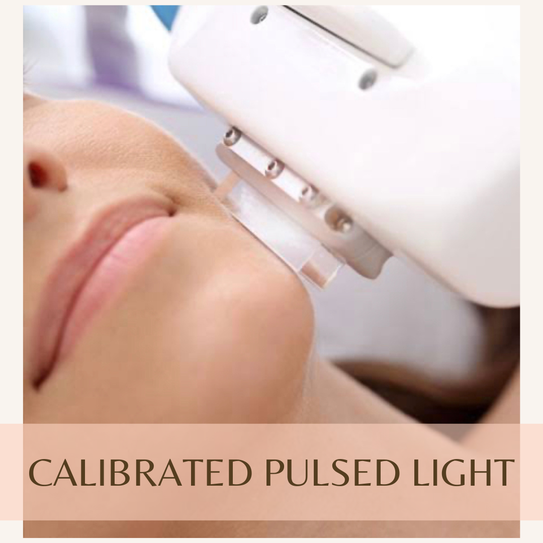 CPL Calibrated Pulsed Light treatment Beauty Bliss