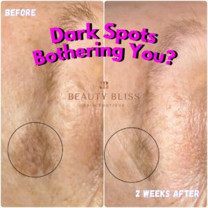 Skin Concerns
