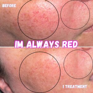 Skin Concerns(1)