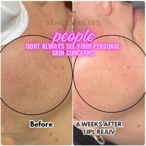 Skin Concerns(2)