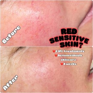 Skin Concerns(3)
