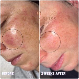 Skin Concerns(4)