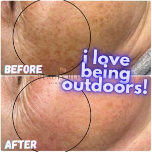 Skin Concerns(5)