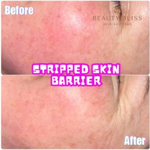 Skin Concerns(6)