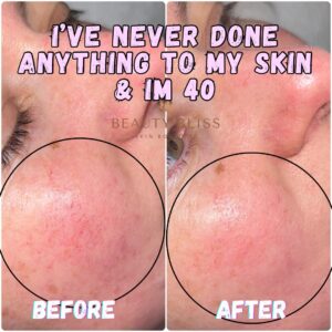 Skin Concerns(7)