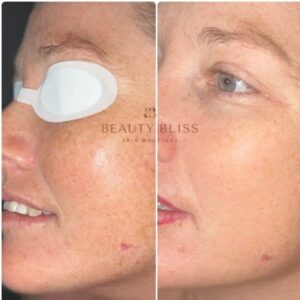 Beforeandafter5