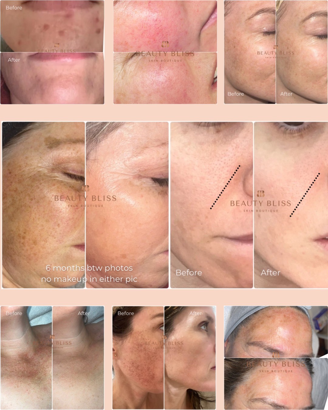 Cover skin transformation