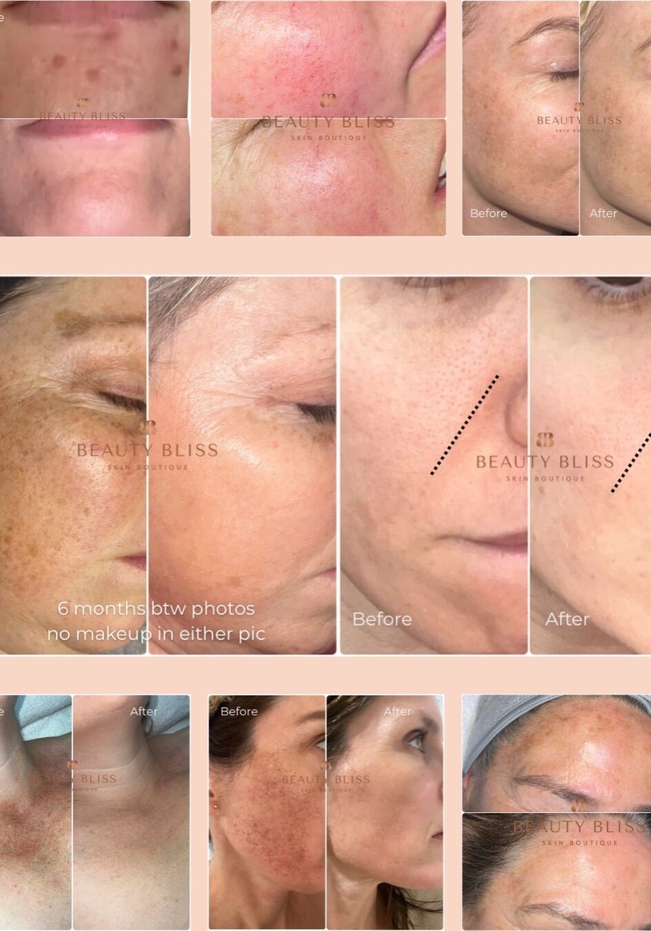 skin transformation